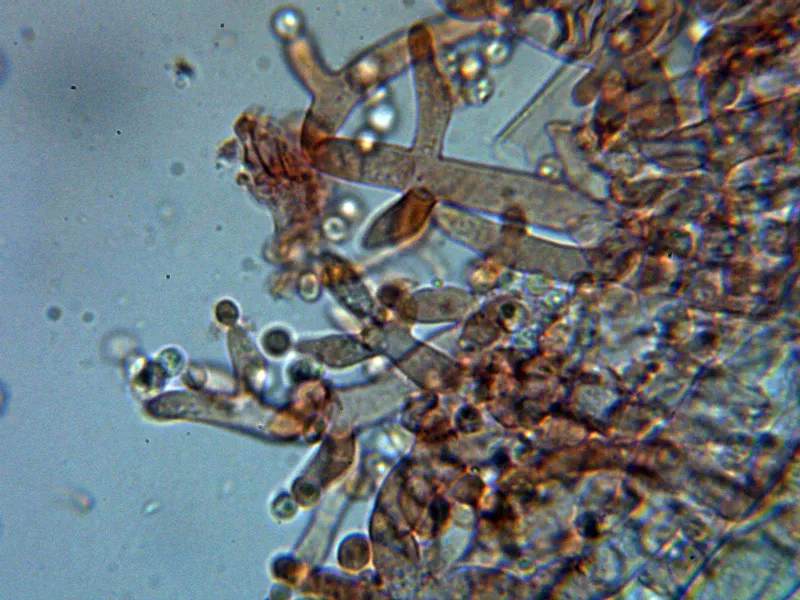 Chromelosporiopsis coerulescens 10 - Conidióforos 2